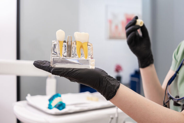 A dental professional in black gloves holds a clear model showing a dental implant with the post and crown. The modern clinic setting emphasizes advanced dental care and education.