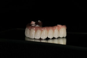 a full arch of teeth with holes in it for implants to be placed in the jaw