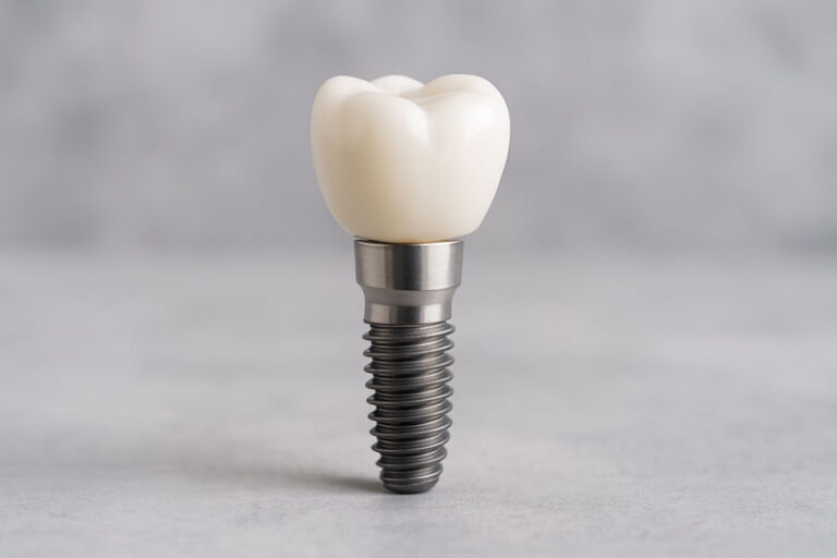 a single dental implant with a crown on top of it
