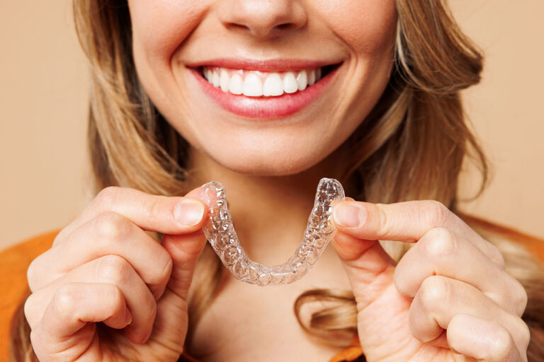 What Are Clear Aligners and Are They For Me?