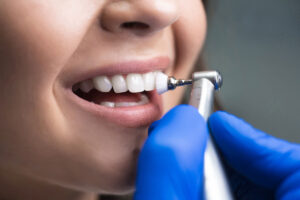 GBT Certified Dental Cleanings in Sherwood, OR: A Modern Approach to Preventive Care